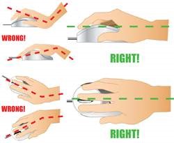 avoid carpel tunnel syndrome